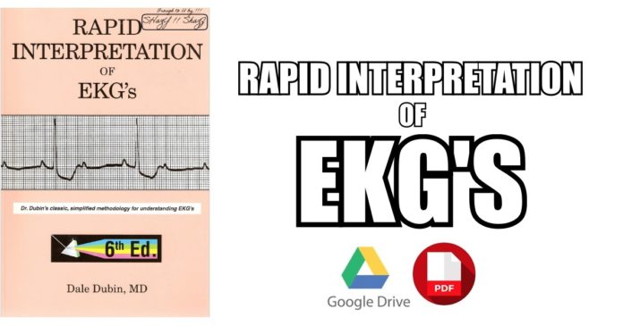 Rapid-Interpretation-of-EKGs-PDF-Free-Download